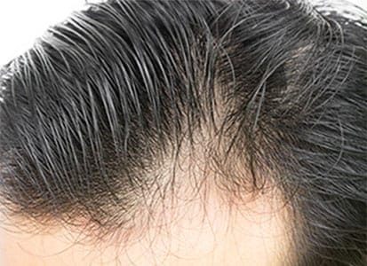 Klinik Kecantikan PIK Bedah Plastik Terbaik di Jakarta Utara