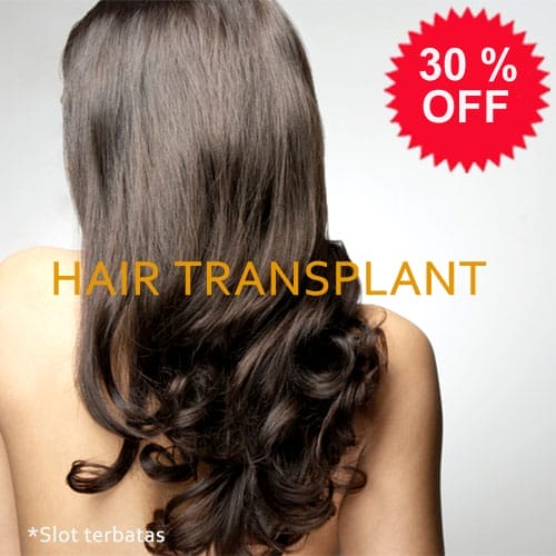 Promo hair transplant